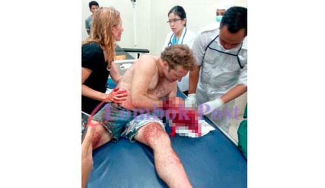 3 surfistas atacados en Lombok